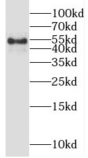 OSBPL2 antibody|OSBPL2抗体 FNab0