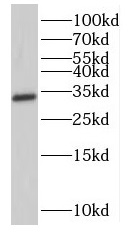 NMRAL1 antibody|NMRAL1抗体