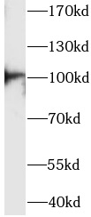ACTN3 antibody|ACTN3抗体 FNab100