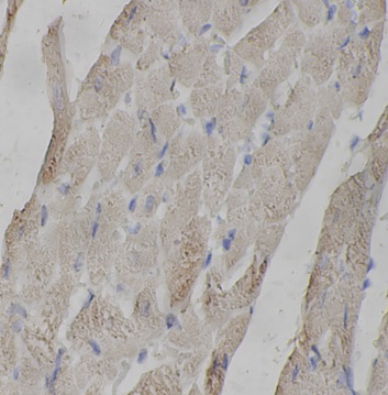 MYBPC3 antibody|MYBPC3抗体 FNab1