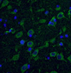 HTT antibody|HTT抗体