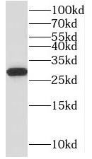 MRPL10 antibody|MRPL10抗体