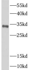 NAT1 antibody|NAT1抗体 FNab09978