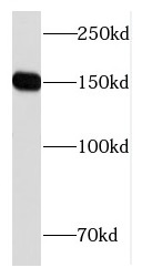 CPS1 antibody|CPS1抗体 FNab01934