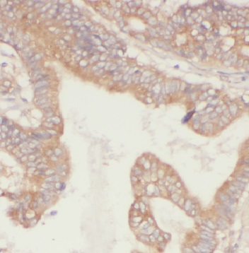 FBF1 antibody|FBF1抗体 FNab03026