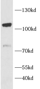 SIK2 antibody|SIK2抗体
