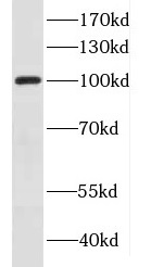 DNM1 antibody|DNM1抗体