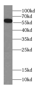 FIZ1 antibody|FIZ1抗体 FNab02509