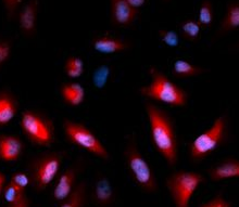 Phospho-HSPB1 (S82) antibody|P