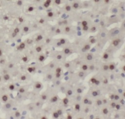 RUVBL1 antibody|RUVBL1抗体