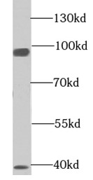 EML1 antibody|EML1抗体