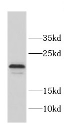 CCDC12 antibody|CCDC12抗体