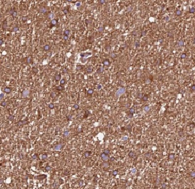 DCTN2 antibody|DCTN2抗体 FNab025