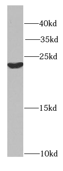 HIKESHI antibody|HIKESHI抗体 FNa