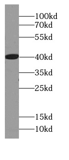 AZGP1 antibody|AZGP1抗体 FNab007