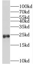 CSH1 antibody|CSH1抗体 FNab06513