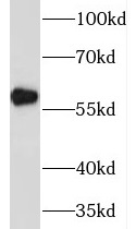 MAOB antibody|MAOB抗体 FNab04972