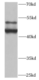 SMAD9 antibody|SMAD9抗体