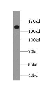 TMF1-Specific antibody|TMF1抗体