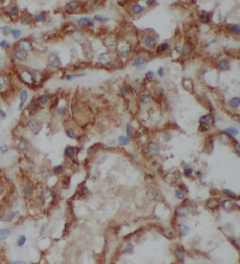 KLHL29 antibody|KLHL29抗体