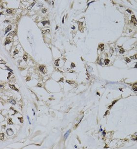 PML antibody|PML抗体