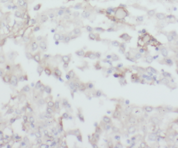 CPOX antibody|CPOX抗体 FNab01869