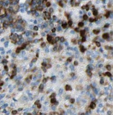 TPPP antibody|TPPP抗体 FNab08897