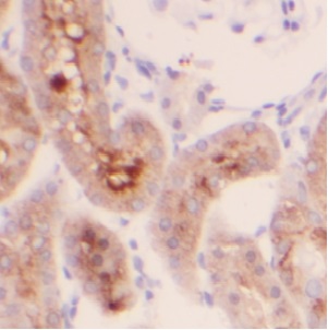 USP20 antibody|USP20抗体