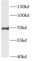ARHGEF7 antibody|ARHGEF7抗体