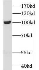 OTUD7B antibody|OTUD7B抗体
