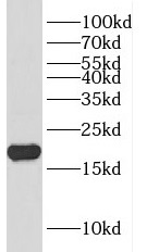DCTPP1 antibody|DCTPP1抗体