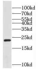 KHDC3L antibody|KHDC3L抗体