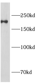 ITGAM antibody|ITGAM抗体 FNab014