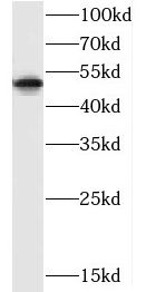 CXCR1 antibody|CXCR1抗体