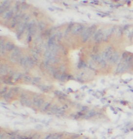 TRAF1 antibody|TRAF1抗体 FNab100