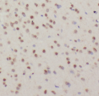 DHX9 antibody|DHX9抗体