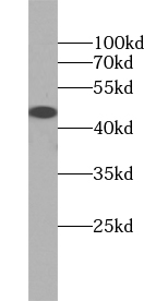 ZNF763 antibody|ZNF763抗体