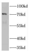 TNK1 antibody|TNK1抗体