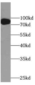 SP1 antibody|SP1抗体 FNab08131