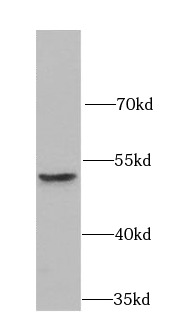 MICA antibody|MICA抗体 FNab05176