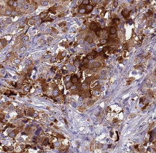 ATG12 antibody|ATG12抗体 FNab006