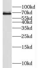 HSD11B1 antibody|HSD11B1抗体