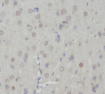 CHRNA7 antibody|CHRNA7抗体