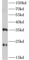 TSPAN12 antibody|TSPAN12抗体 FNa