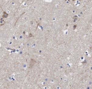 TAFA5 antibody|TAFA5抗体