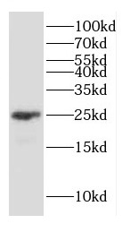 GJB2 antibody|GJB2抗体 FNab01859