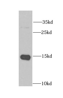 CRABP2 antibody|CRABP2抗体