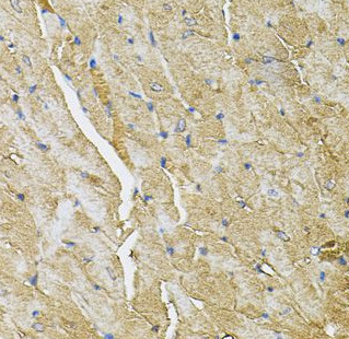 TRPC1 antibody|TRPC1抗体