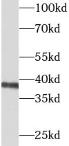 BCAT2 antibody|BCAT2抗体