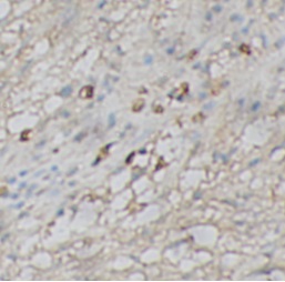 CASP1 antibody|CASP1抗体 FNab100